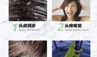 生长头发的洗发露